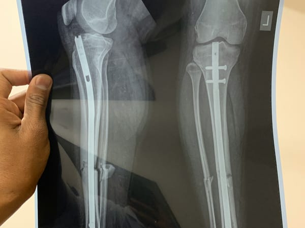 Opzeggen fitnessabonnement om medische redenen moet makkelijker, zo wil minister